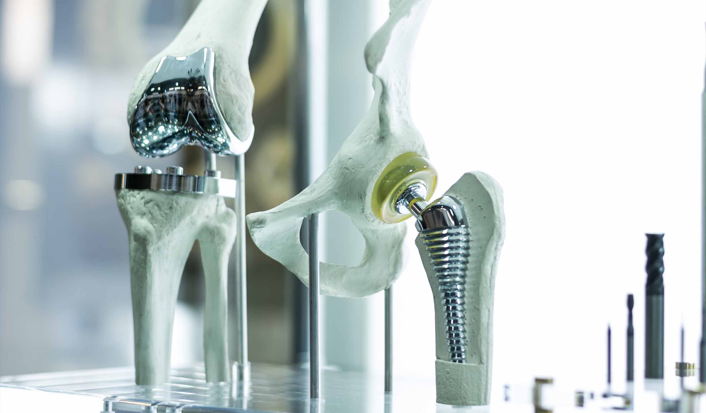 Metal-on-Metal Hip Implants – Risk Assessment